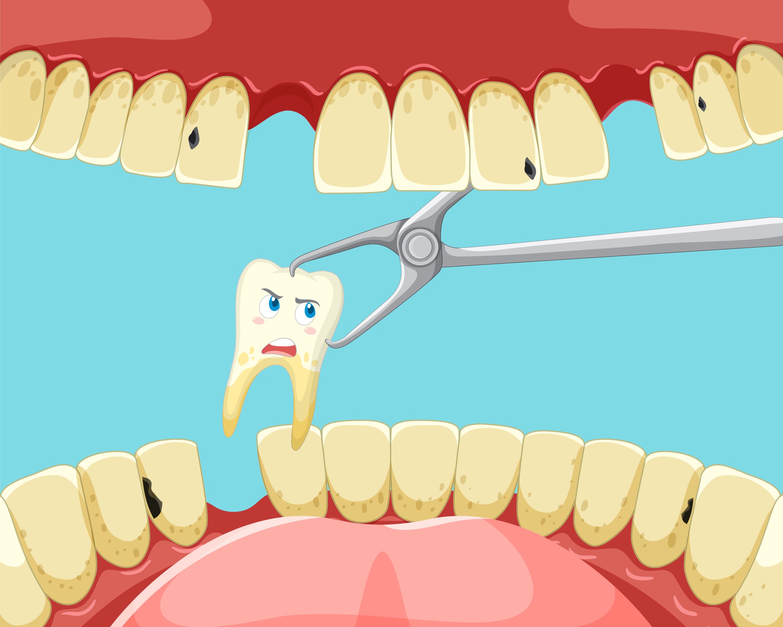root canal vs extraction