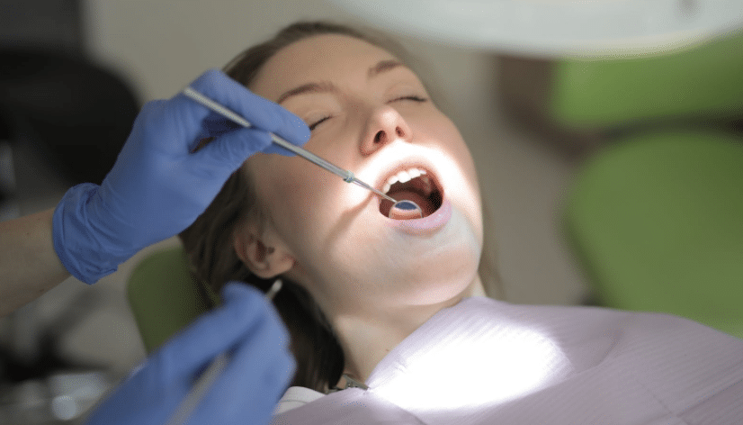 Dental Fillings