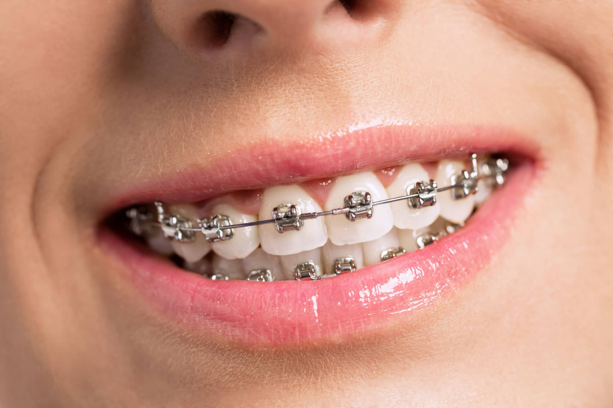 dental services