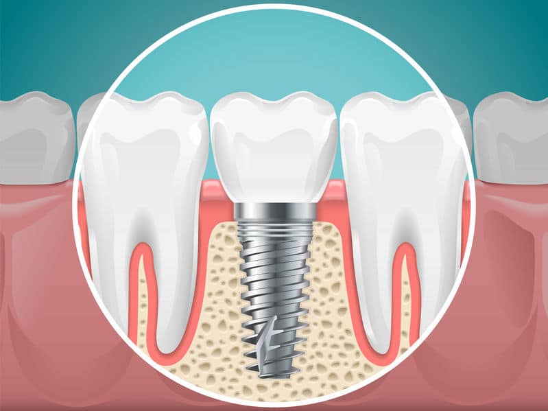 dental services