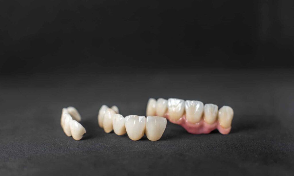 Dental Crowns