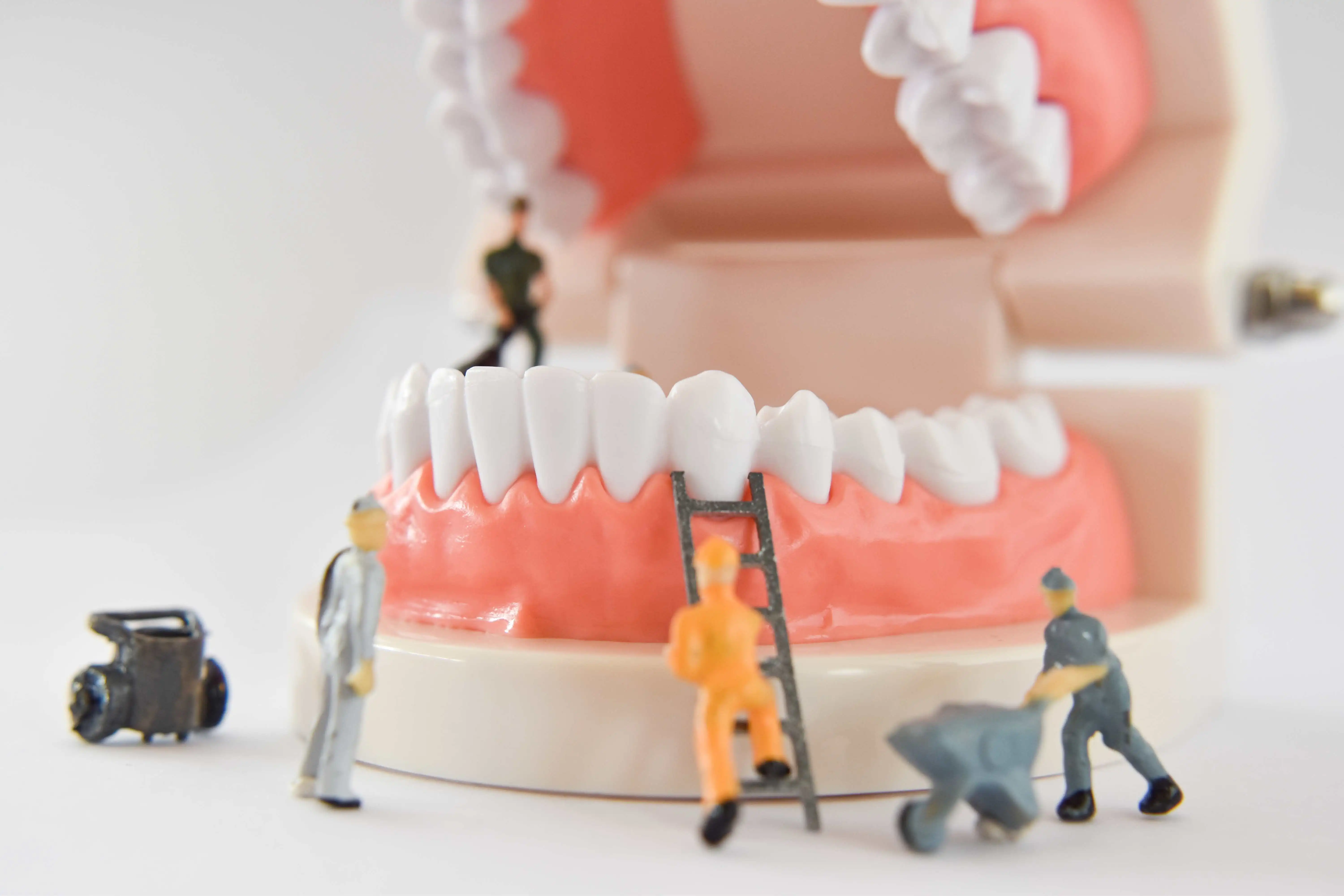 Dental Implants The Advantages
