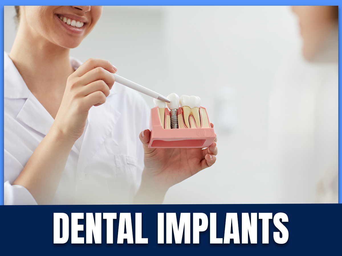 How Long Do Dental Implants Last