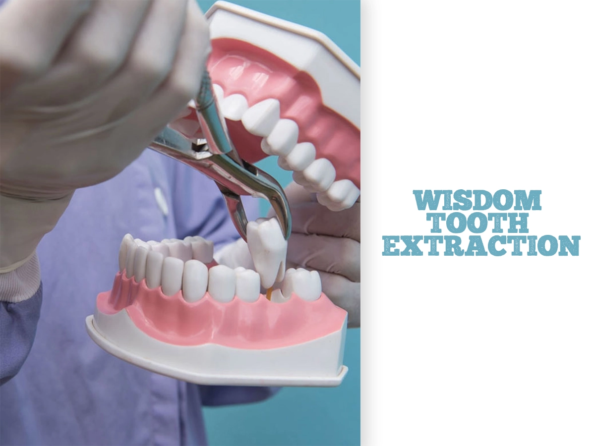 Wisdom Tooth Extraction