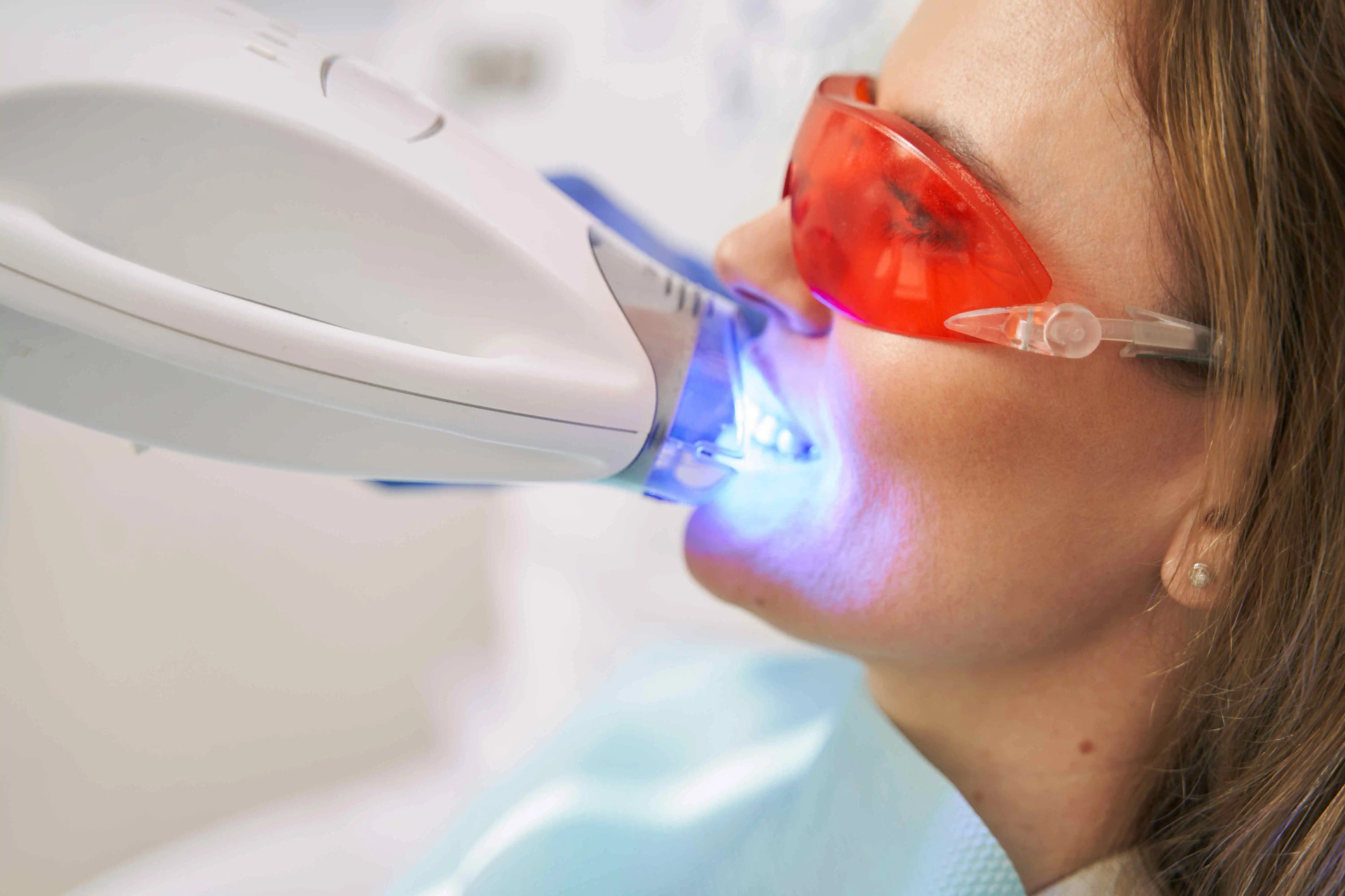 Does Teeth Whitening Damage Your Teeth?