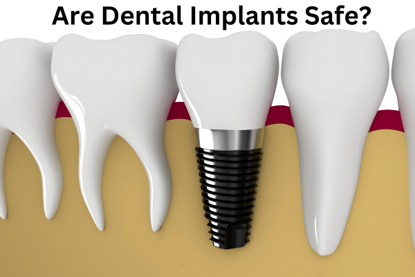 Are Dental Implants Safe