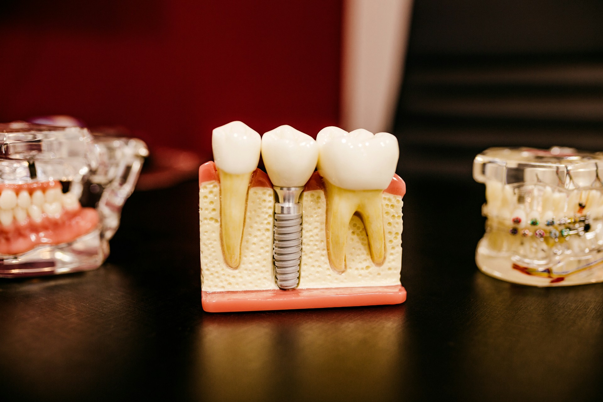 Dental crown problems