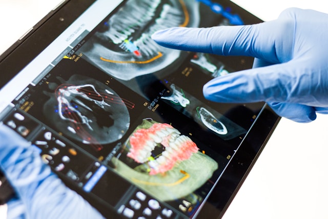 dental implants for seniors