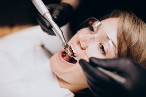 dentist reshaping teeth