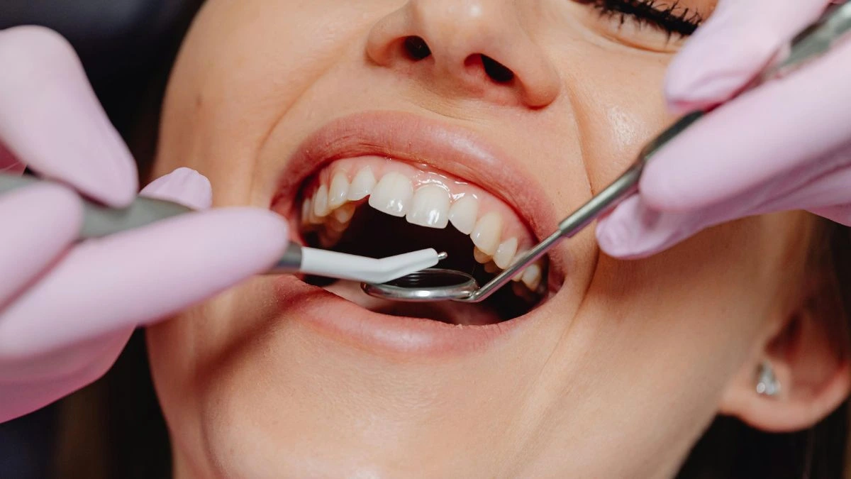 gingivitis vs periodontitis
