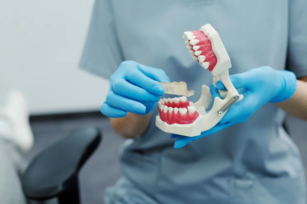 dental implants vs bridges