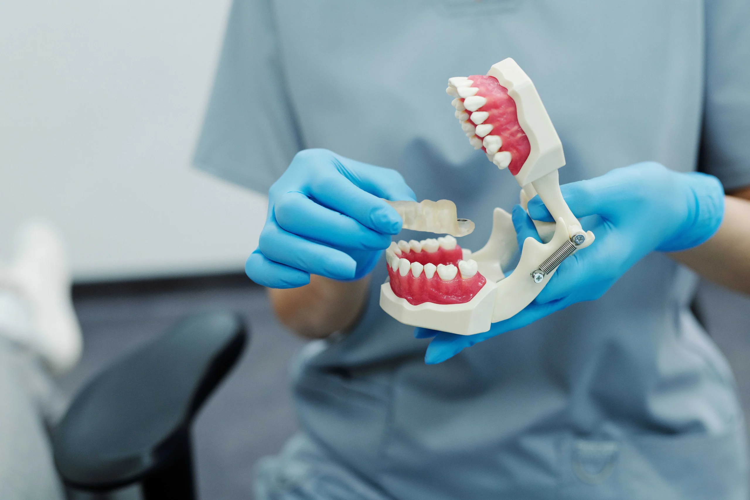 dental implants vs bridges