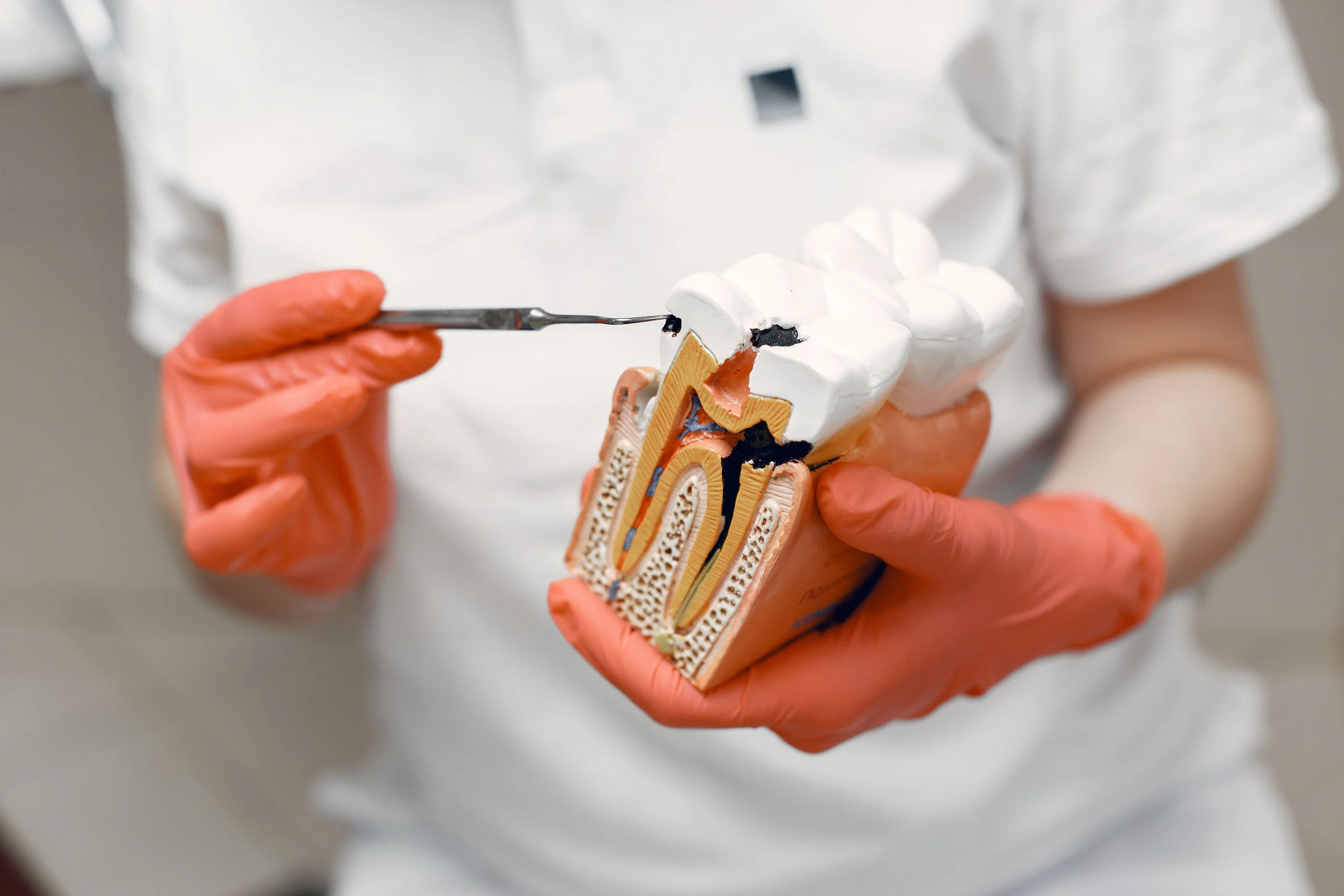 signs you need a root canal